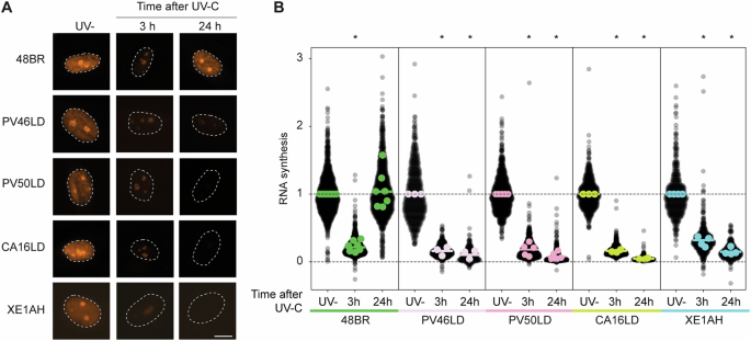 Fig. 4: CA16LD and XE1AH fibroblasts are deficient in TCR.