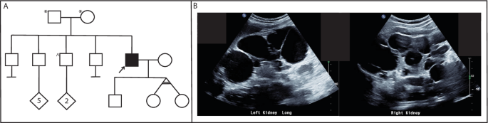 Fig. 2: Pedigree of RBW402.