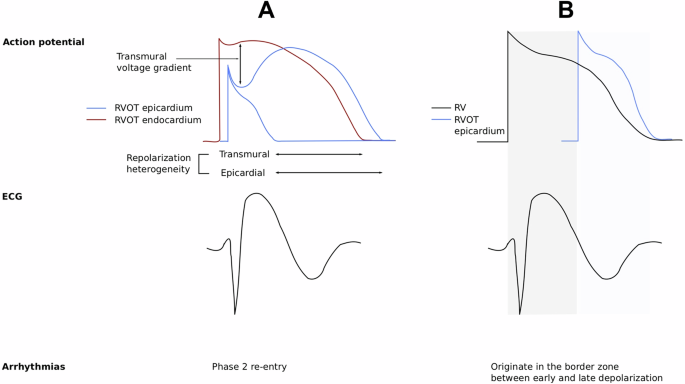 Fig. 2: Electrophysiological theories underpinning the pathophysiology of Brugada Syndrome.