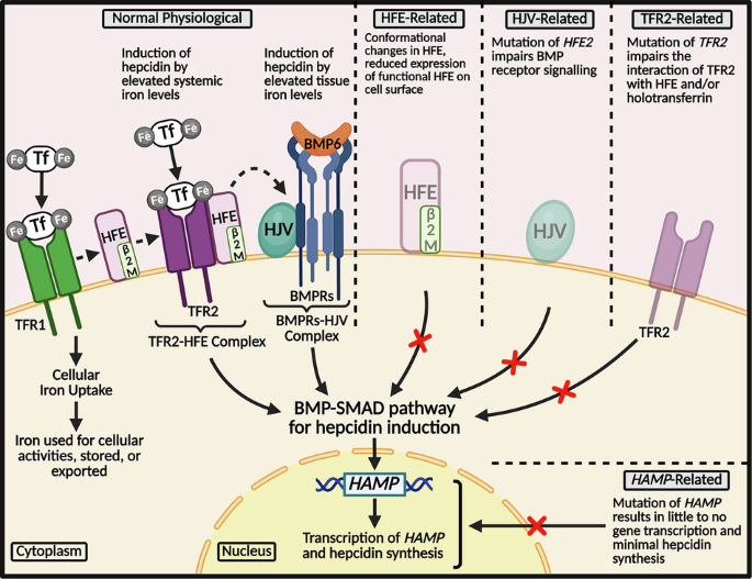 Fig. 1: Overview of the mechanisms underlying the types of haemochromatosis.