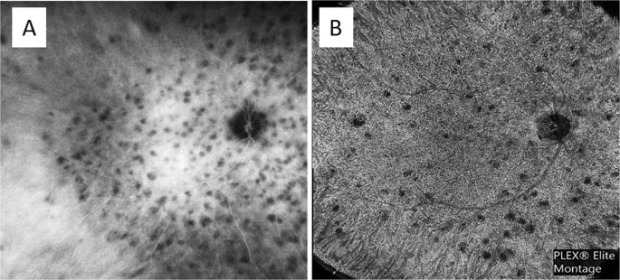 figure 16