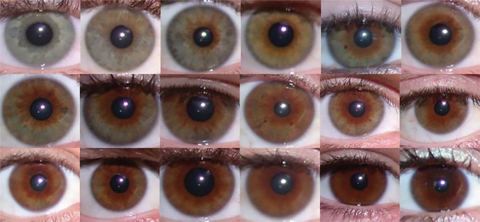 What colour are your eyes? Teaching the genetics of eye colour & colour Edridge Green Lecture Annual Glasgow May 2019 | Eye