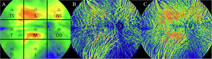 Fig. 1: Methods for choroidal segmentation and relevant parameter measurements.