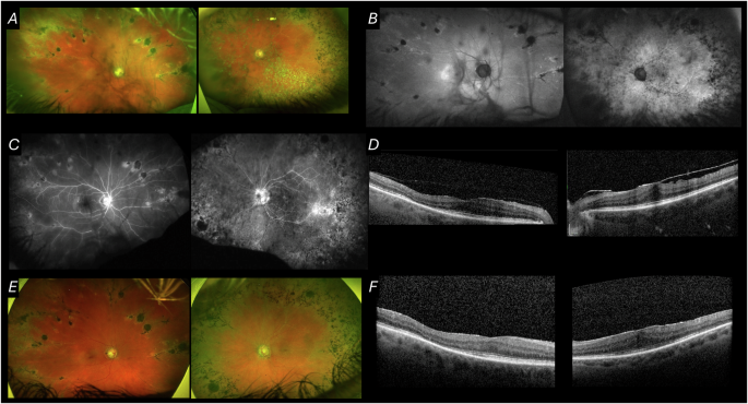 Fig. 2: Multimodal imaging from Case 3.
