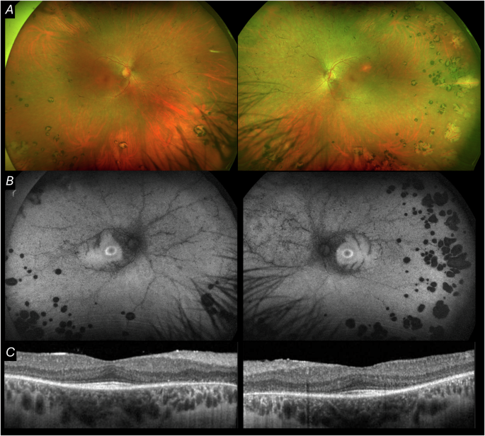 Fig. 4: Multimodal imaging from Case 5.