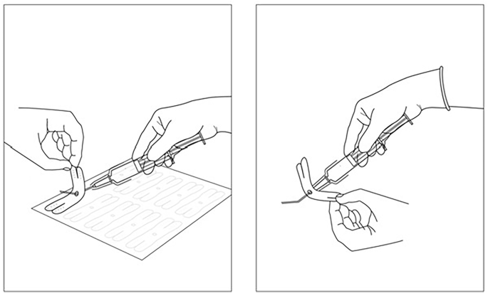 Fig. 1: Application process is shown whereby the tape is lifted from the carrier sheet and the cannula passed through the hole.