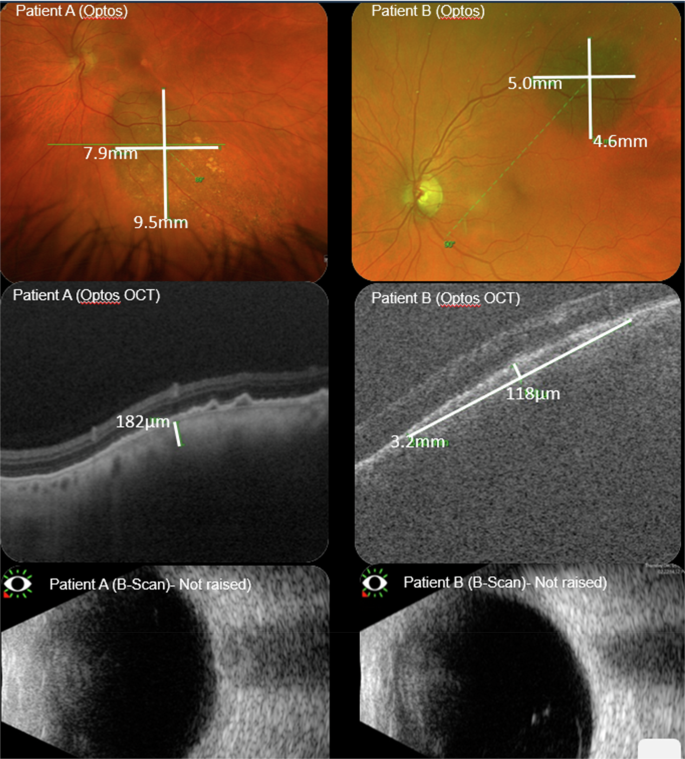 Fig. 1: Examples of patient images and scans.