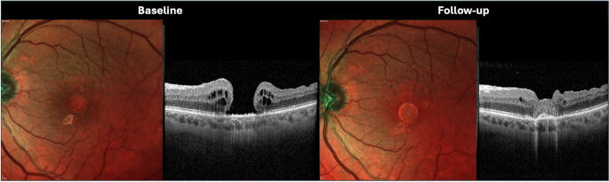 Fig. 1: Representative case.