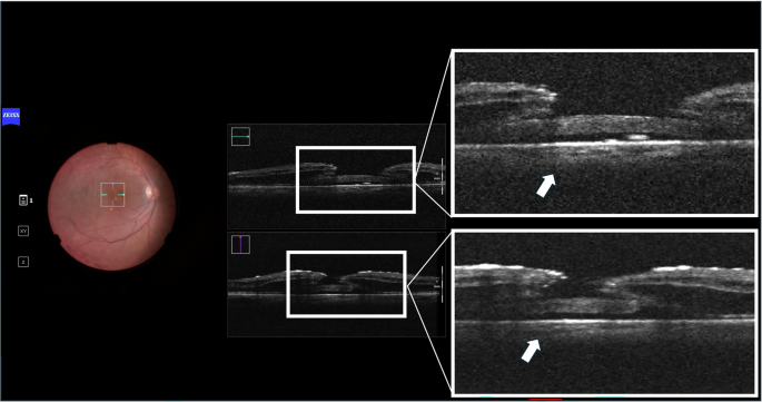Fig. 2: Intraoperative view.