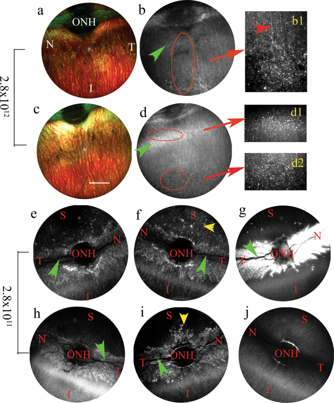 vrh 10 Transduces Outer Retinal Cells In Rodents And Rabbits Following Intravitreal Administration Gene Therapy