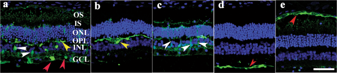 vrh 10 Transduces Outer Retinal Cells In Rodents And Rabbits Following Intravitreal Administration Gene Therapy