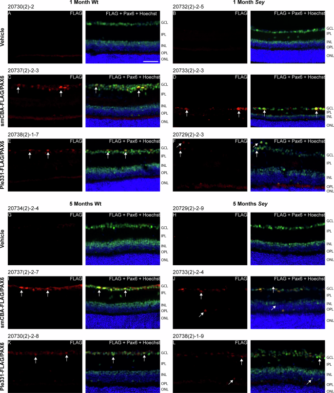 Fig. 4: Both smCBA-FLAG/PAX6 and Ple331-FLAG/PAX6 viruses successfully delivered FLAG-tagged PAX6 to therapeutically relevant cells in the retina.