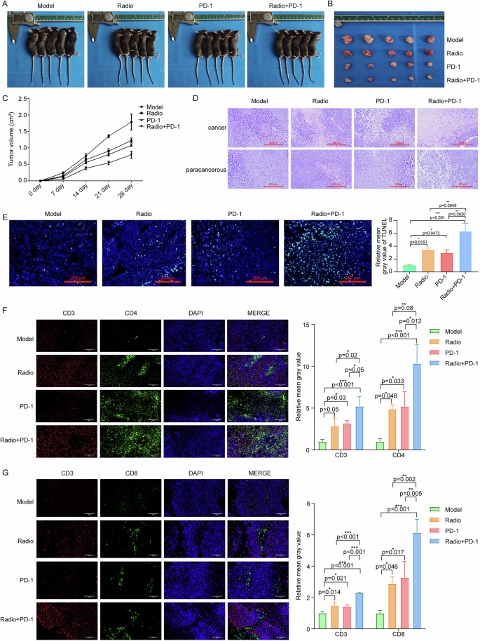 Fig. 1: Radiotherapy combined with PD-1 immunotherapy enhances CD4+ and CD8+ T cell recruitment and promotes tumor cell apoptosis in C57BL/6 mice bearing Hepa1-6 tumors.