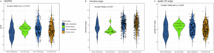 Fig. 4: Angiogenesis in brain metastases.