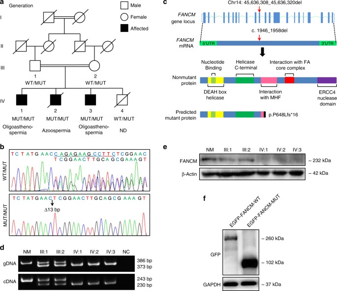 Fig. 1: Identification of a FANCM frameshift PV in a consanguineous family with male infertility.