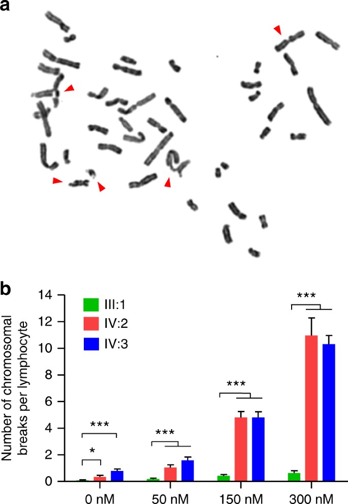 Fig. 2: FANCM PV impairs DNA break repair in patients.
