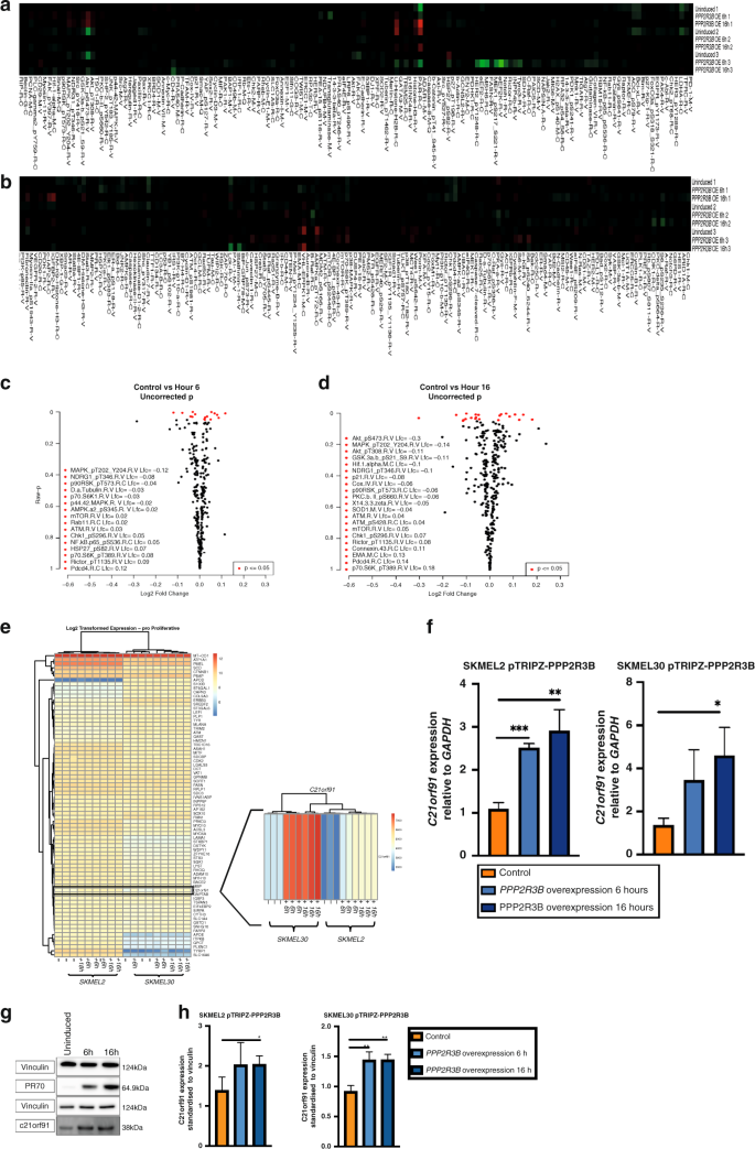 Fig. 4: PPP2R3B overexpression affects mTOR/p70S6K1 and HIF-1 signaling pathways.
