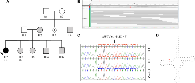 Fig. 3: Family with mitochondrial variant in MT-TV gene.