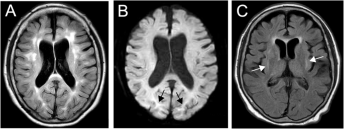 Fig. 1: Clinical and radiological features of the patient.