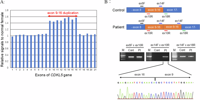 A case of CDKL5 deficiency disorder with a novel intragenic multi ...