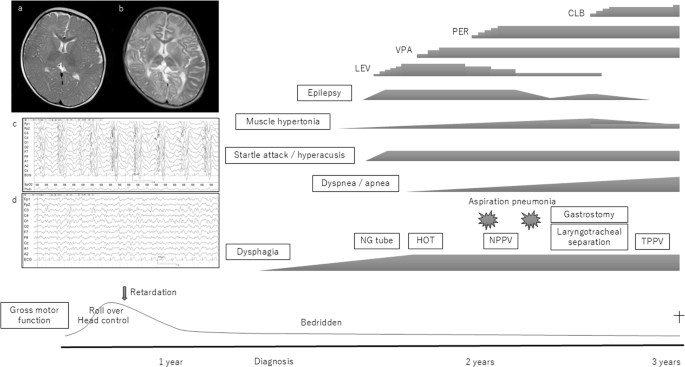 Fig. 2: Clinical course.