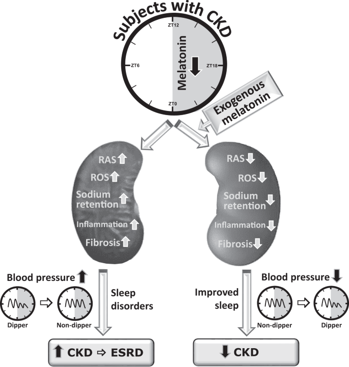 Melatonin in chronic kidney disease: a promising chronotherapy targeting  the intrarenal renin–angiotensin system | Hypertension Research