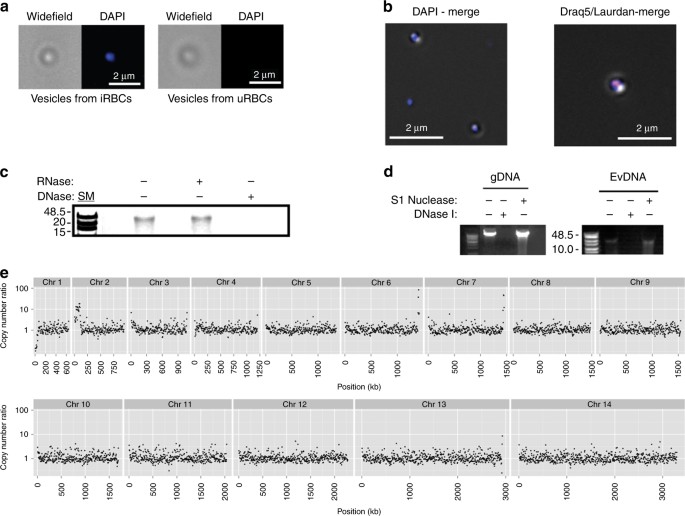 Various ways by which P. falciparum parasite evades the immune system via  secreted extracellular vesicles