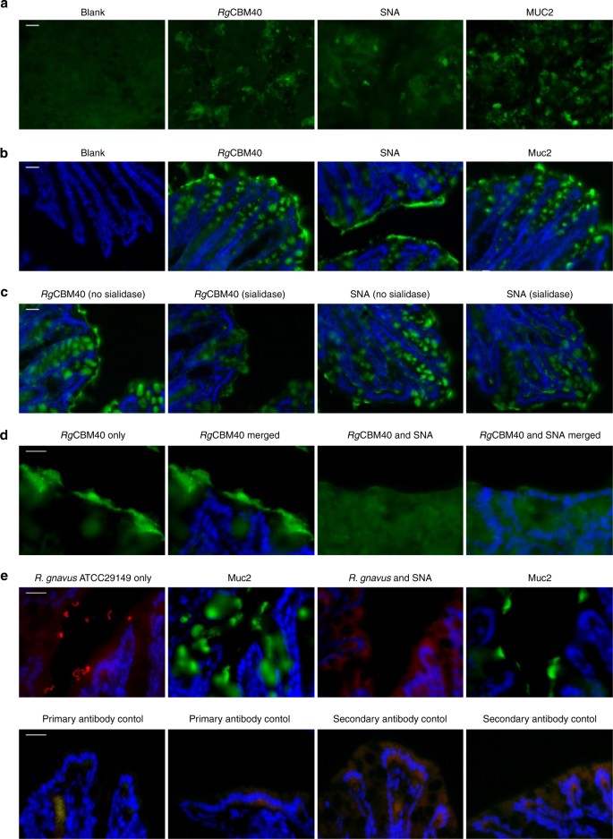 Unravelling the specificity and mechanism of sialic acid recognition by the  gut symbiont Ruminococcus gnavus | Nature Communications