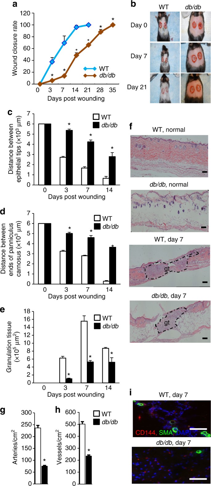 Diabetes impairs wound healing by Dnmt1-dependent dysregulation of  hematopoietic stem cells differentiation towards macrophages | Nature  Communications