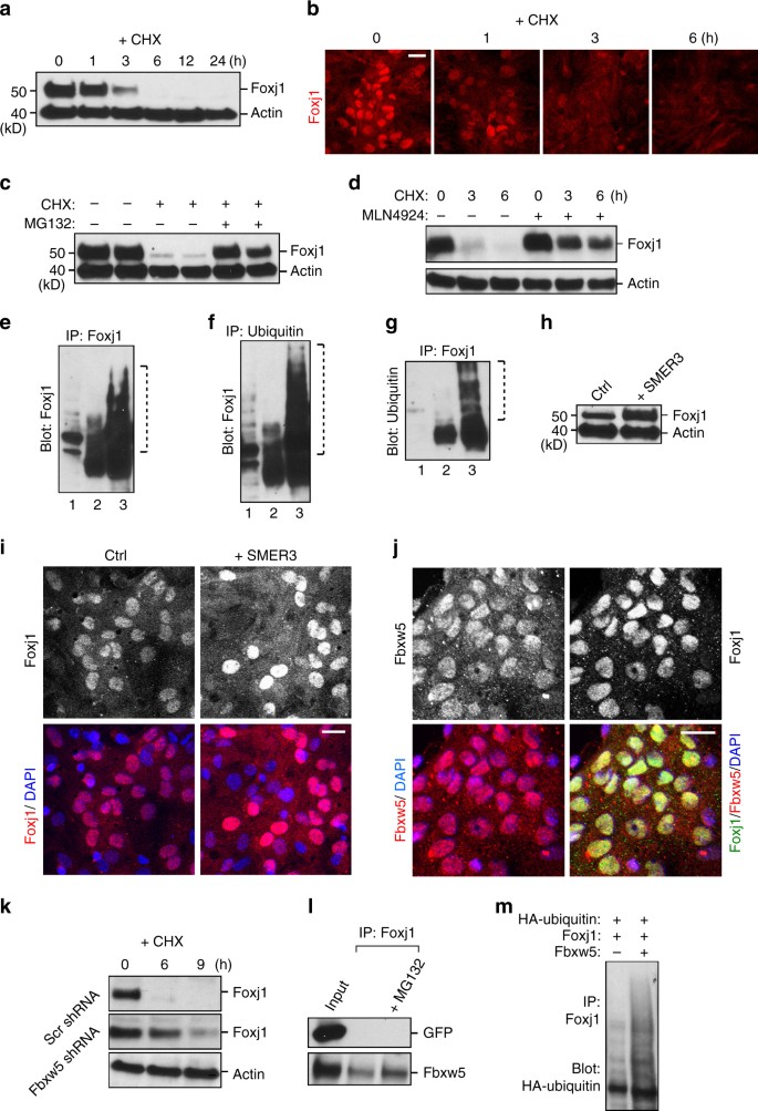 Uncovering Inherent Cellular Plasticity Of Multiciliated Ependyma Leading To Ventricular Wall Transformation And Hydrocephalus Nature Communications Uncovering Inherent Cellular Plasticity Of Multiciliated Ependyma Leading To Ventricular Wall Transformation And Hydrocephalus Nature Communications