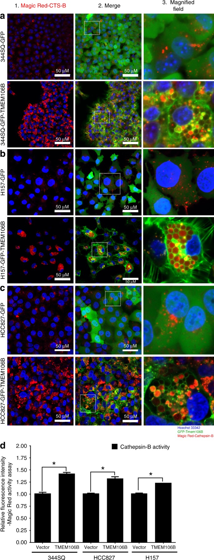 TMEM106B drives lung cancer metastasis by inducing TFEB-dependent lysosome  synthesis and secretion of cathepsins | Nature Communications