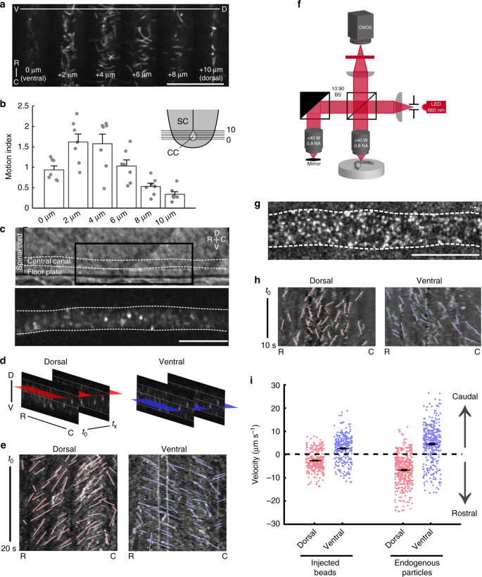 Pkd2l1 Is Required For Mechanoception In Cerebrospinal Fluid Contacting Neurons And Maintenance Of Spine Curvature Nature Communications