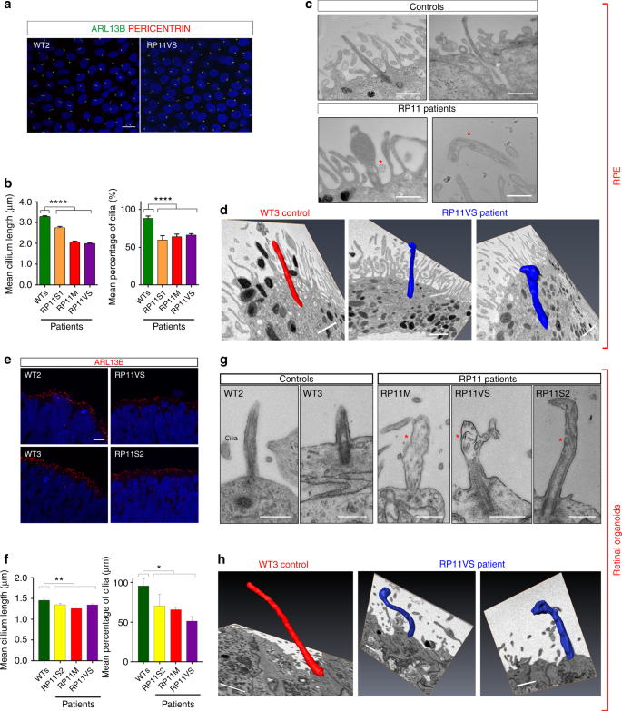 Disrupted Alternative Splicing For Genes Implicated In Splicing And Ciliogenesis Causes Prpf31 Retinitis Pigmentosa Nature Communications<script async src=