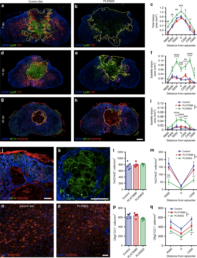 Microglia Are An Essential Component Of The Neuroprotective Scar That Forms After Spinal Cord Injury Nature Communications