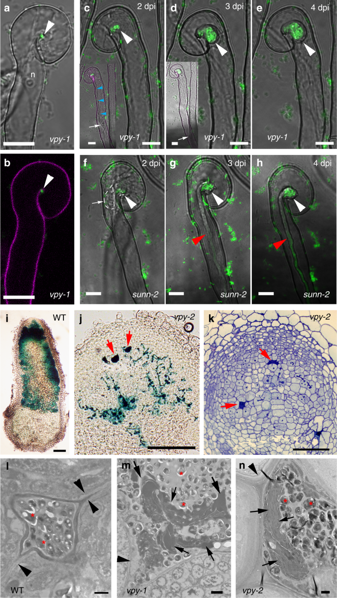 A Protein Complex Required For Polar Growth Of Rhizobial Infection Threads Nature Communications A Protein Complex Required For Polar Growth Of Rhizobial Infection Threads Nature Communications