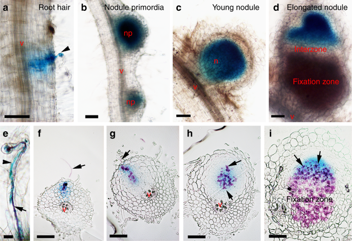 A Protein Complex Required For Polar Growth Of Rhizobial Infection Threads Nature Communications A Protein Complex Required For Polar Growth Of Rhizobial Infection Threads Nature Communications