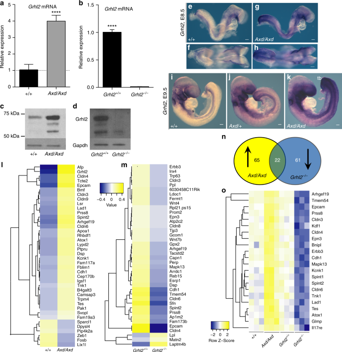 Pathogenesis of neural tube defects: The regulation and disruption of  cellular processes underlying neural tube closure - Engelhardt - 2022 -  WIREs Mechanisms of Disease - Wiley Online Library