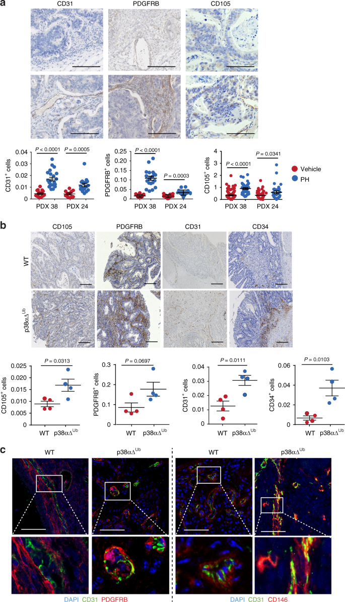 Regulation Of Tumor Angiogenesis And Mesenchymal Endothelial Transition By P38a Through Tgf B And Jnk Signaling Nature Communications