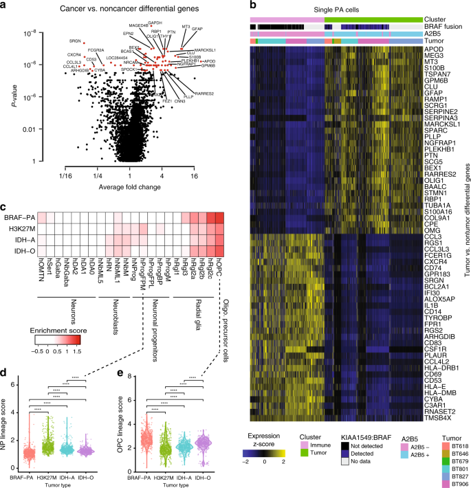 Mitogenic And Progenitor Gene Programmes In Single Pilocytic Astrocytoma Cells Nature Communications