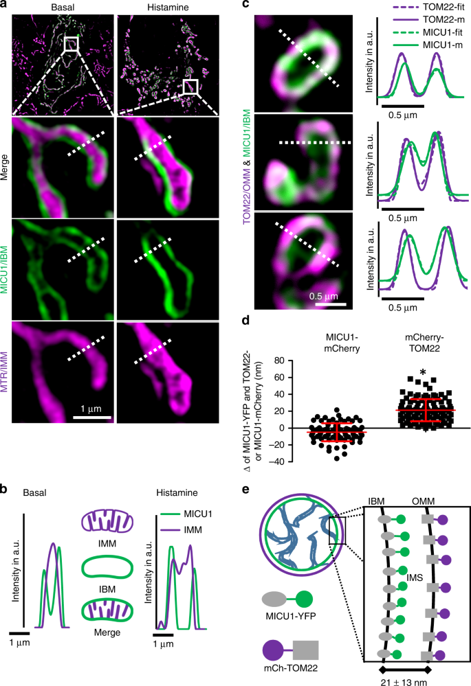 Micu1 Controls Cristae Junction And Spatially Anchors Mitochondrial Ca 2 Uniporter Complex Nature Communications