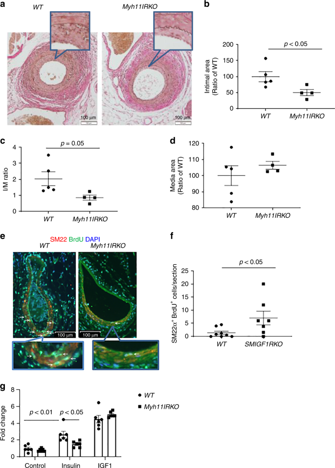 Homozygous receptors for insulin and not IGF-1 accelerate intimal hyperplasia in insulin resistance and diabetes | Nature Communications Homozygous receptors for insulin and not IGF-1 accelerate intimal hyperplasia in insulin resistance and diabetes | Nature Communications