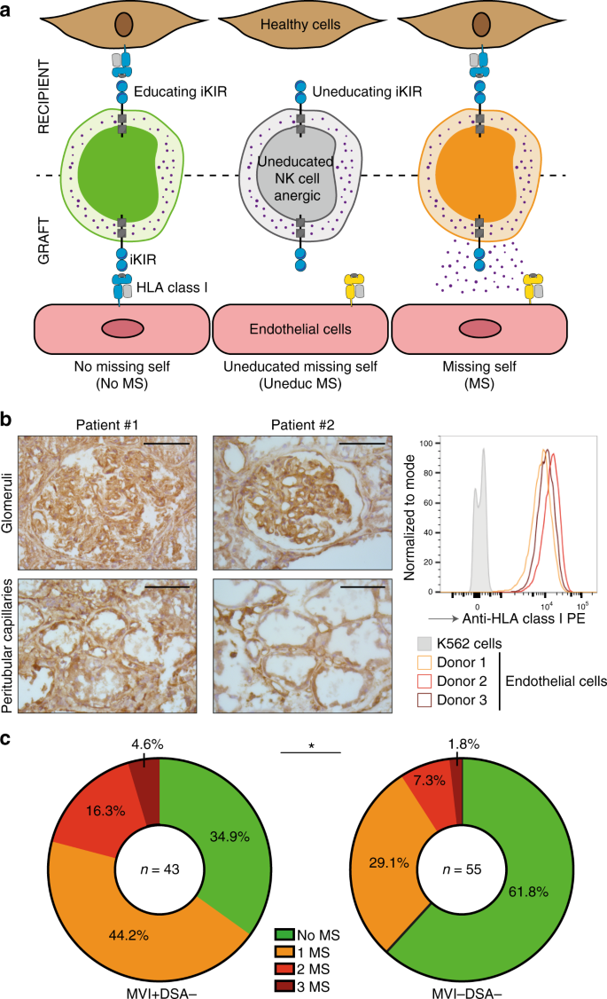 Missing Self Triggers Nk Cell Mediated Chronic Vascular Rejection Of Solid Organ Transplants Nature Communications