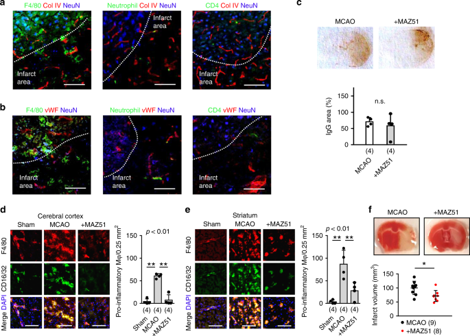 Brain-to-cervical lymph node signaling after stroke | Nature Communications