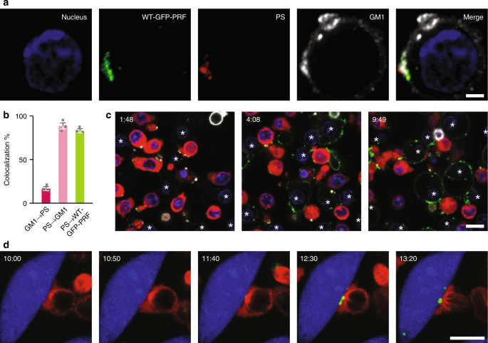 Lipid Order And Charge Protect Killer T Cells From Accidental Death Nature Communications