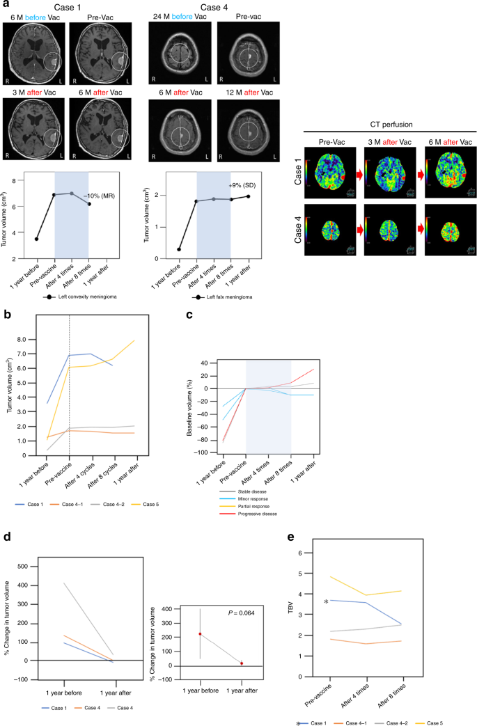 Fig. 2: Radiographic analysis of meningiomas after vaccination.
