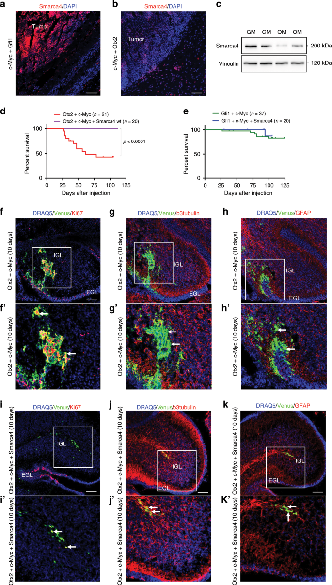 Modeling Medulloblastoma In Vivo And With Human Cerebellar Organoids Nature Communications