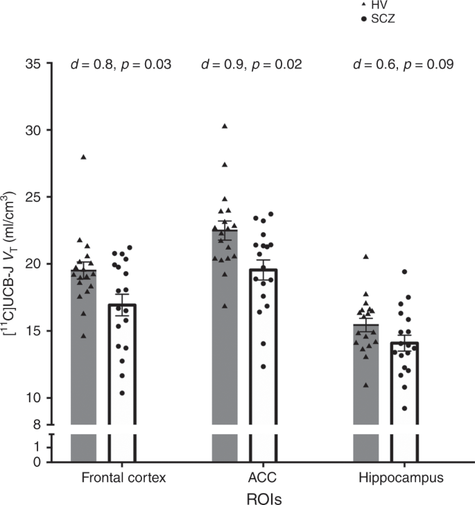 Synaptic Density Marker Sv2a Is Reduced In Schizophrenia Patients And Unaffected By Antipsychotics In Rats Nature Communications