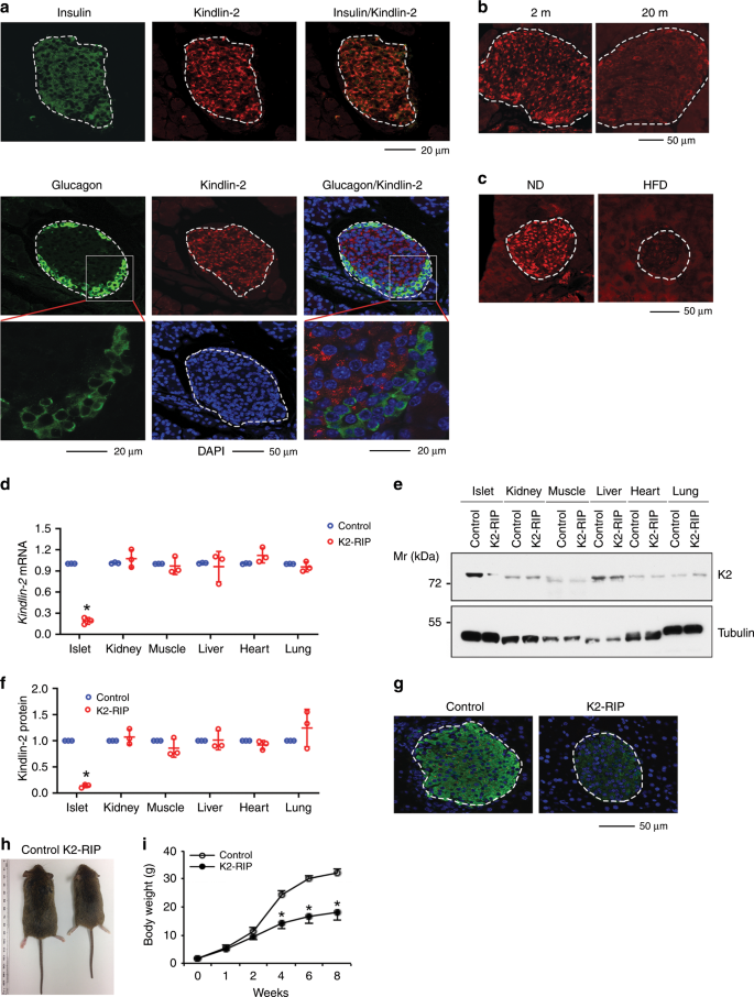 Kindlin 2 Modulates Mafa And B Catenin Expression To Regulate B Cell Function And Mass In Mice Nature Communications