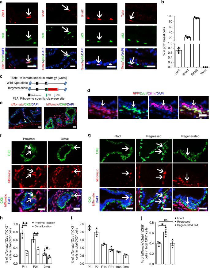 Fig. 1: Zeb1+ basal cells are more frequently detected in the urethra-proximal region.