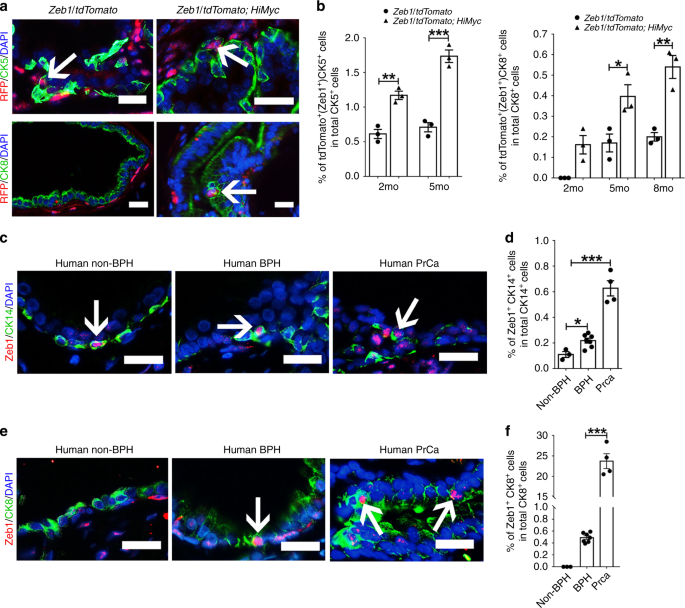 Fig. 7: Zeb1+ epithelial cells are found in both mouse and human prostates.